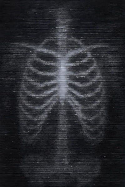 Xray